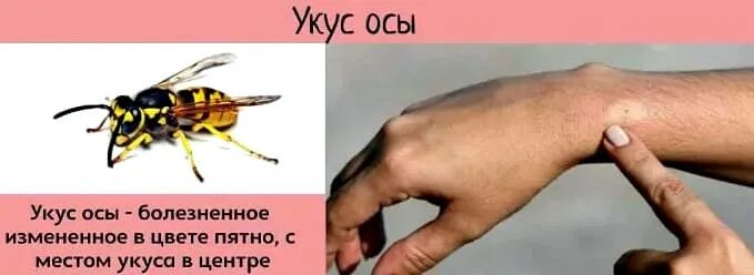 Если тебя укусила оса нужно. Укусы ядовитых насекомых.