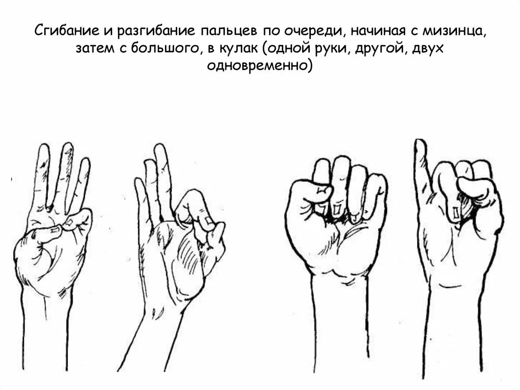 Больно разогнуть палец. Сгибание и разгибание пальцев. Сгибание разгибание пальцев рук. Упражнения для пальцев. Упражнение для рук с большими пальцами.