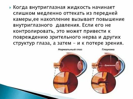 Симптомы внутриглазного давления