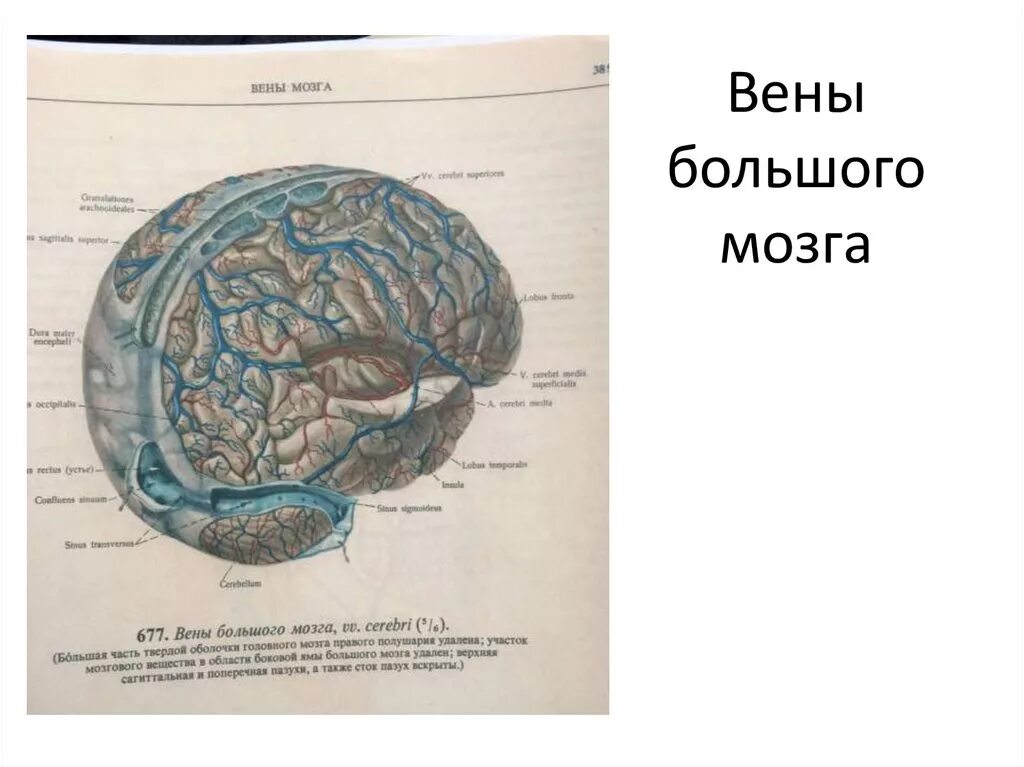 Вены головного мозга. Большая Вена мозга Вена Галена. Большая Вена головного мозга.