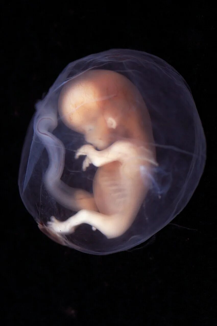 Эмбрион на 9 неделе беременности фото. Эмбрион на 10 неделе беременности. Эмбрион на 9-10 неделе беременности. Ребенок ребенка 6 8 недель