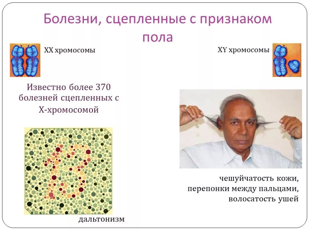 Сцепленные заболевания примеры. Заболевания сцепленные с у хромосомой. Заболевания человека сцепленные с полом. Болезни сцепленные с хромосомой- у человека. Наследственные заболевания сцепленные с у хромосомой.