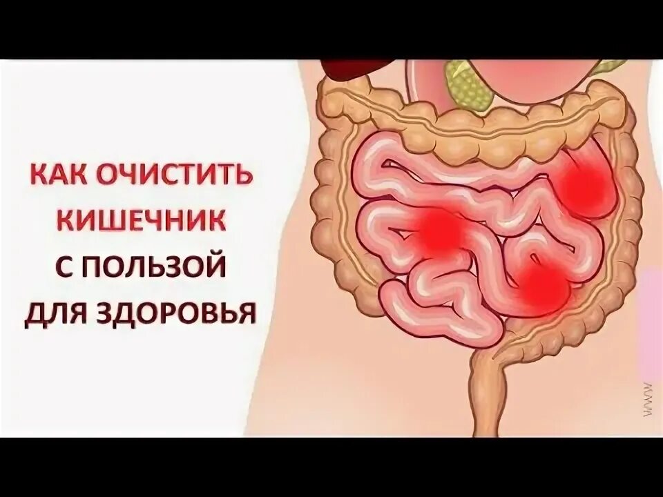 Мешает в кишечнике. Мешает в кишечнике