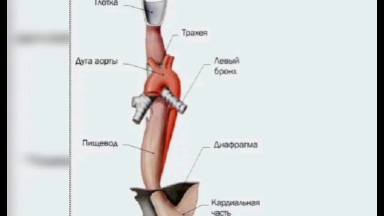 Уровни сужения пищевода