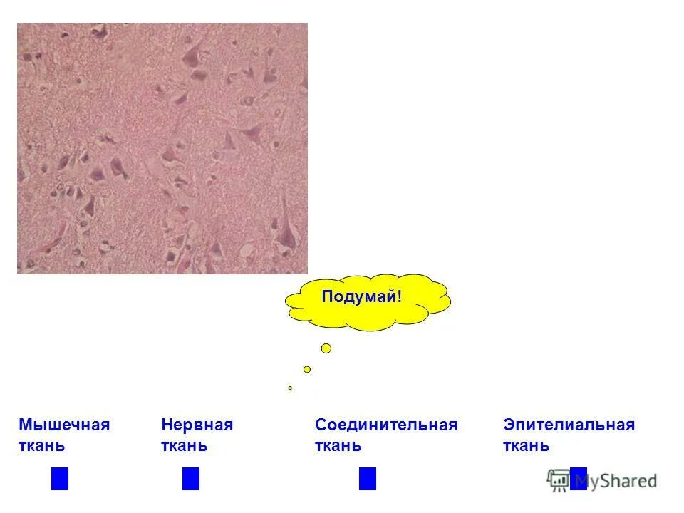 мышечная соединительная нервная. ткани эпителиальные соединительные мышечные нервная. ткани соединительная эпителиальная мышечная нервная жировая. ткани эпителиальные соединительные мышечные нервная. ткани эпителиальные соединительные мышечные нервная.