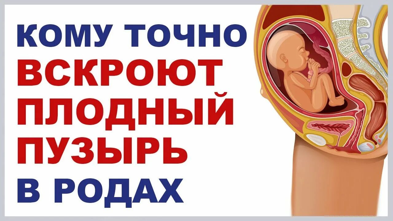 Вскрытие плодного пузыря. Прокол родового пузыря. Прокол пузыря при родах. После прокола пузыря начинаются роды