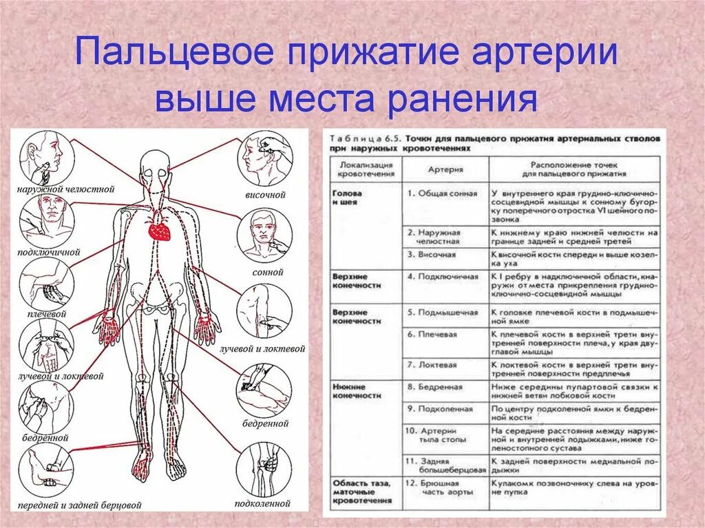 Карта вызова артериальная. Места прижатия артерий при кровотечениях пальцевое. Пальцевое прижание при кров. Техника пальцевого прижатия подколенной артерии. Точки пальцевого прижатия артерий.