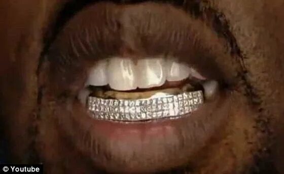 Канье уэст грилзы. Зубы канье уэста. Канье уэст зубы. Канье уэст зубы 2024. Канье уэст грилзы.