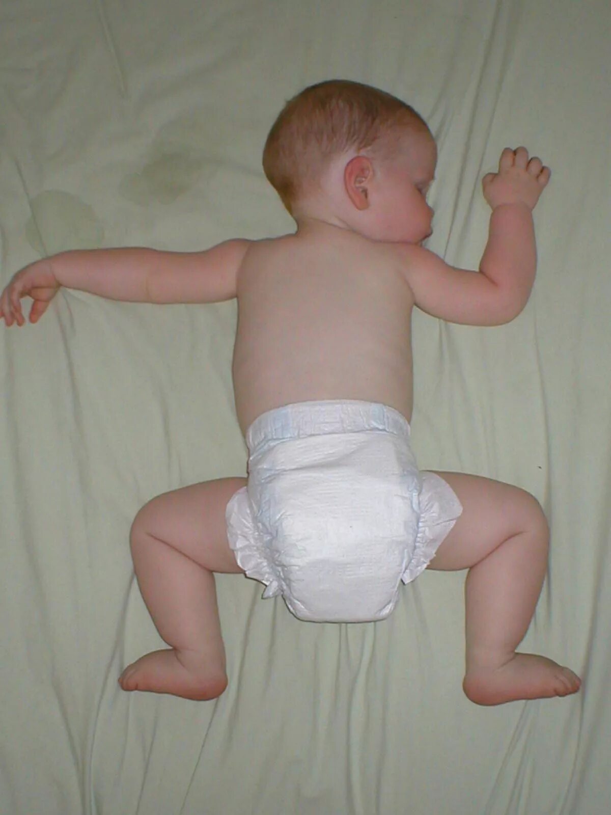 Почему новорожденный выгибается. Гипотонус спины у грудничков. Гипер Ионус ног у грудничка.