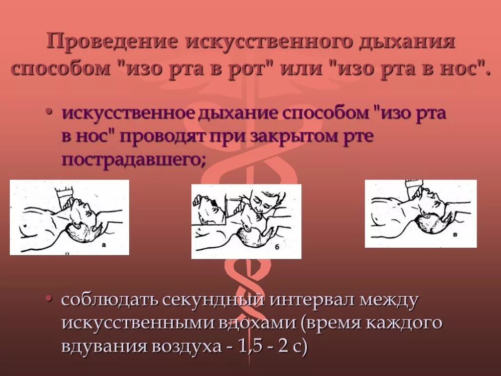 Вдохи 18. Проведение искусственного дыхания рот в нос. При проведении искусственного дыхания рот ко рту. Метод проведения искусственного дыхания. Способ искусственного дыхания изо рта в нос.