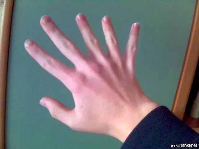 Почему 11 пальцев