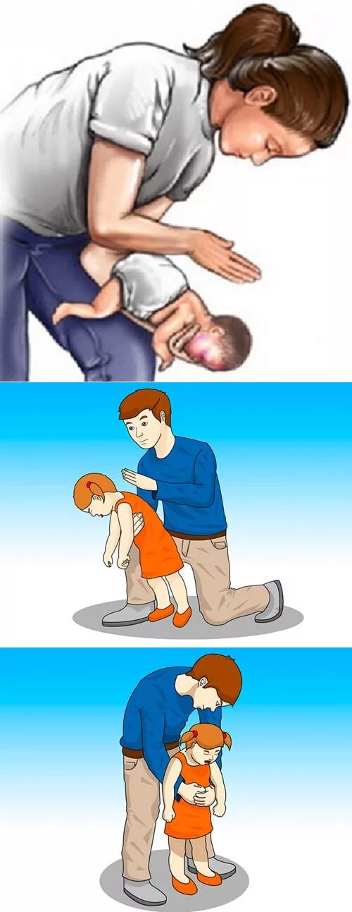 Ребенок поперхнулся. Оказание первой помощи если ребенок подавился. Ребенок сильно давиться. Ребенок сильно давиться. Ребенок сильно давиться.