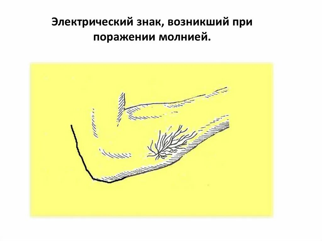 Как выглядят электрические знаки Знаки тока на человеке: найдено 89 картинок