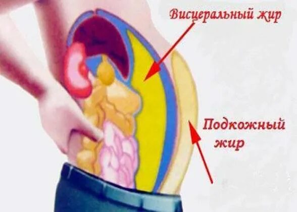 Подкожный жир и висцеральный жир. Висцеральный жир в брюшной полости. Висцеральный жир внутренних органов.