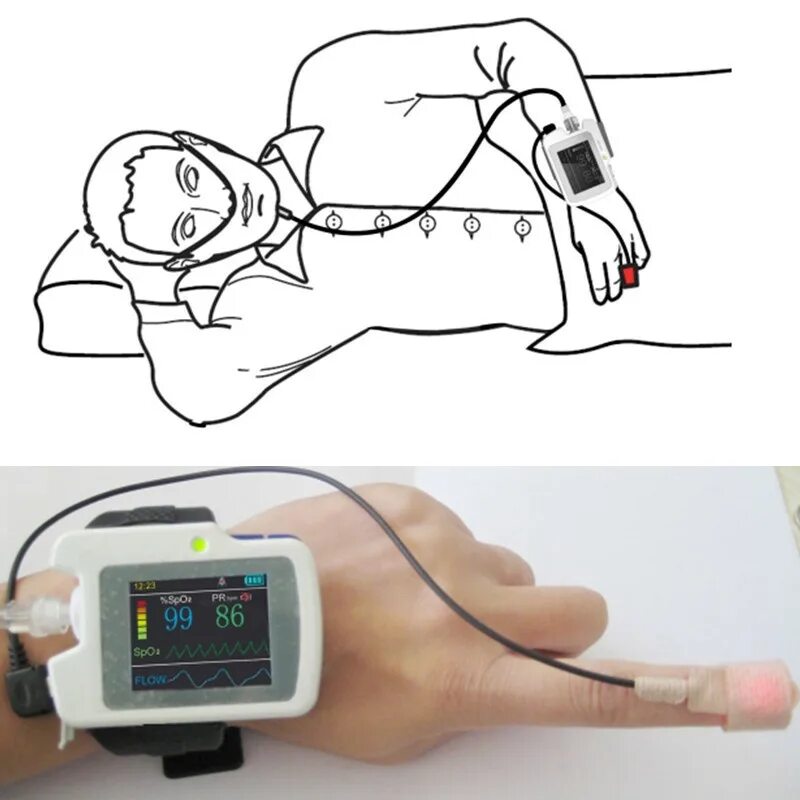 Аппарат для мониторинга сна. Монитор сна. Монитор дыхания. Прибор для измерения апноэ.