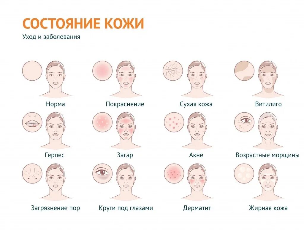 Причины прыщей после 30. Состояние кожи. Типы кожи. Состояние кожи виды.