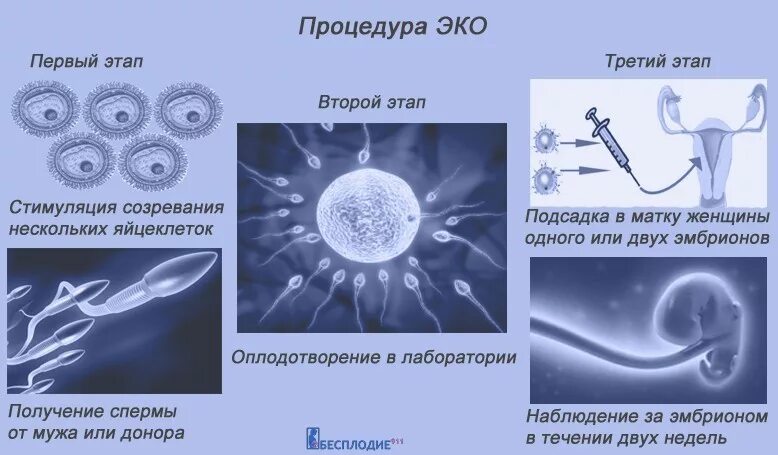 Чем оплодотворение отличается от. Схема экстракорпорального оплодотворения. Оплодотворение яйцеклетки ИКСИ. Эко метод оплодотворения. Эко оплодотворение яйцеклетки в пробирке.