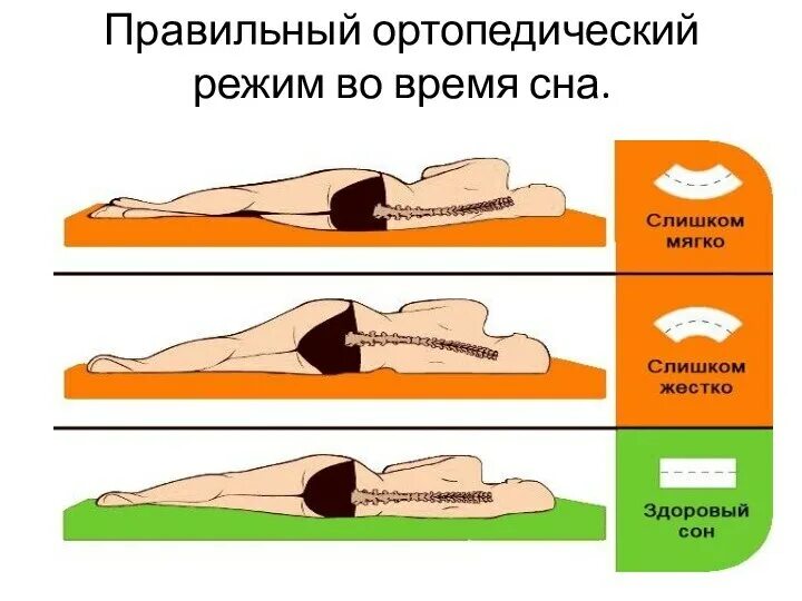 Положение при сне. Правильное положение тела во сне. Правильное положение для сна. Спать при грыже позвоночника. Кровати после операций на позвоночнике