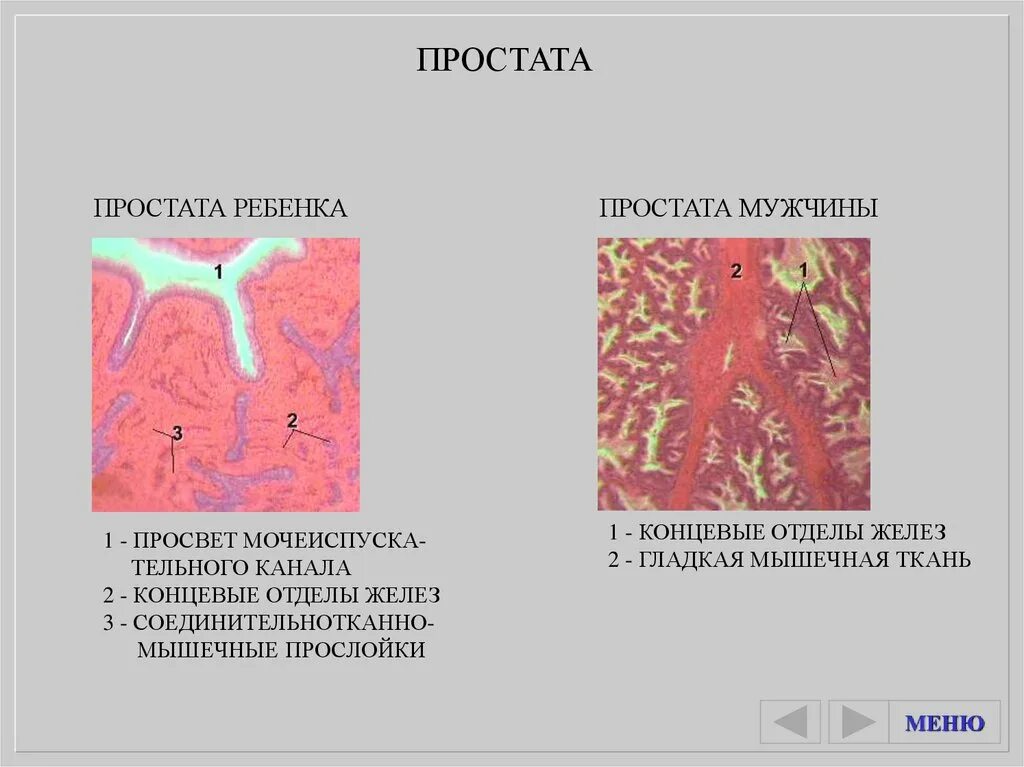 Гистологический препарат предстательной железы. Предстательная железа гистология препарат. Предстательная железа ребенка гистология препарат. Концевые отделы желез гистология.