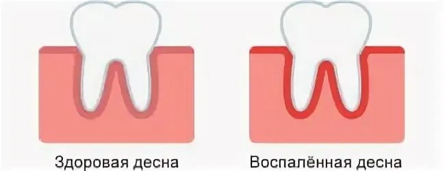 Температура в десне брянск сегодня