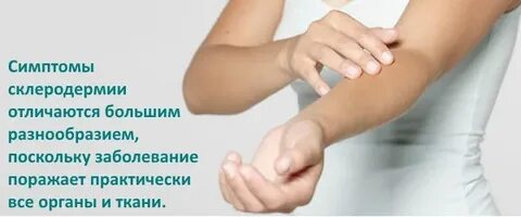 Что такое склеродермия простыми словами
