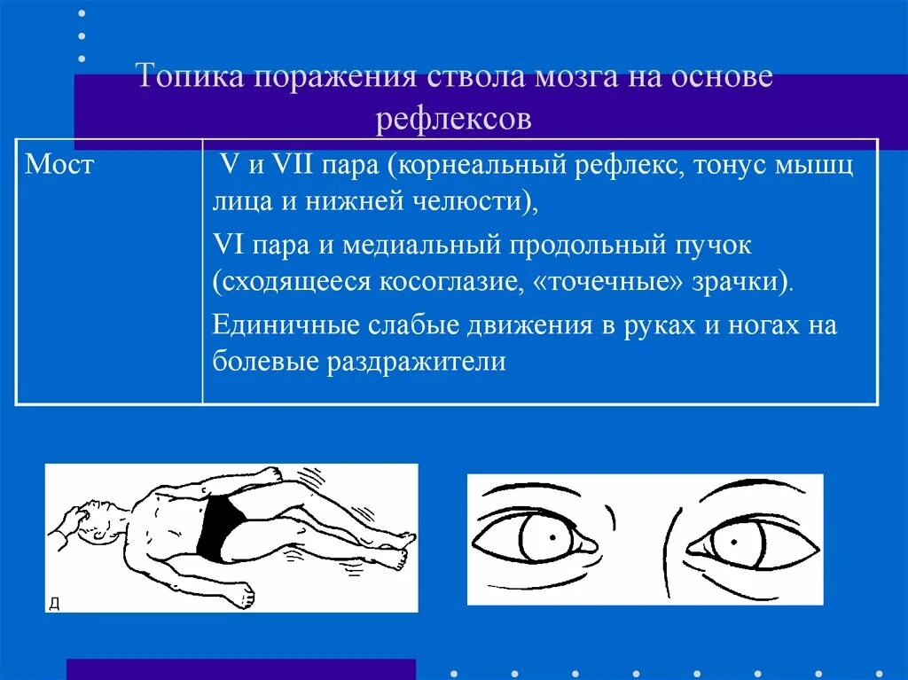 Корнеальные рефлексы. Корнеальный мигательный рефлекс вывод. Корнеальные и конъюнктивальные рефлексы. Исследование роговичного рефлекса.