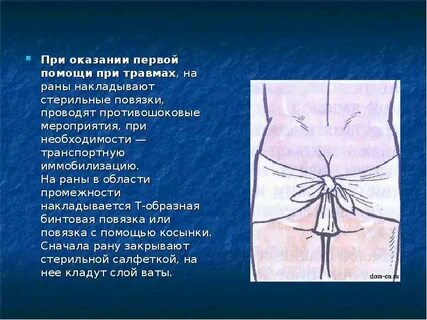 Черепицеобразная повязка накладывается