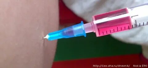 В 12 колоть
