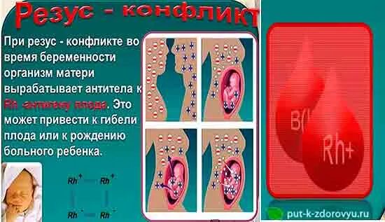 Анализ на резус конфликт. Резус-конфликт при беременности антитела 1:2. Антитела при резус конфликте при беременности. Титр антител резус конфликт. Титр антител при резус конфликте.