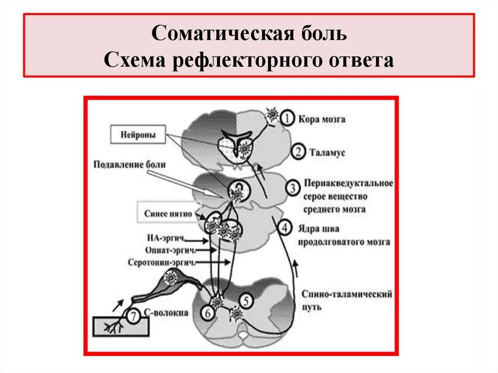 Рефлекторные боли