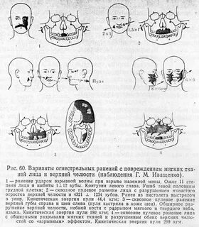 Челюстно лицевые повреждения