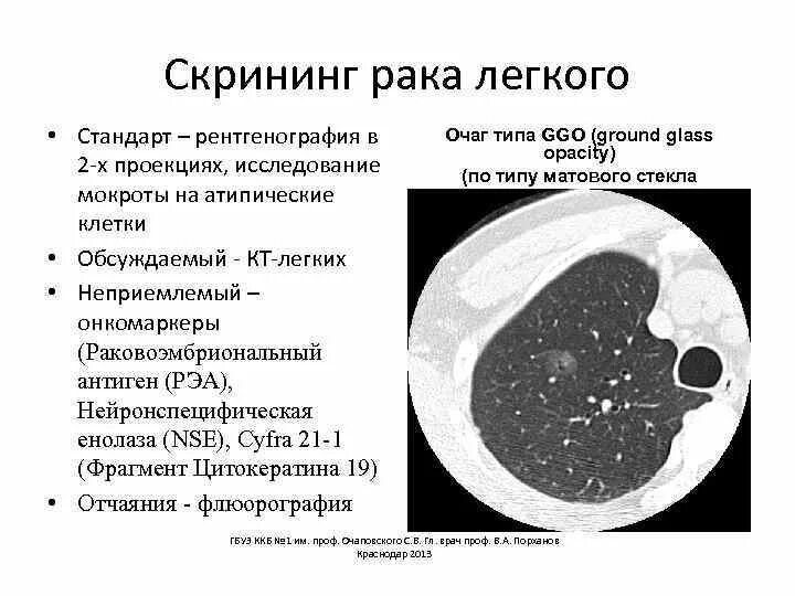 Температура при раке легких. Температура при раке легких