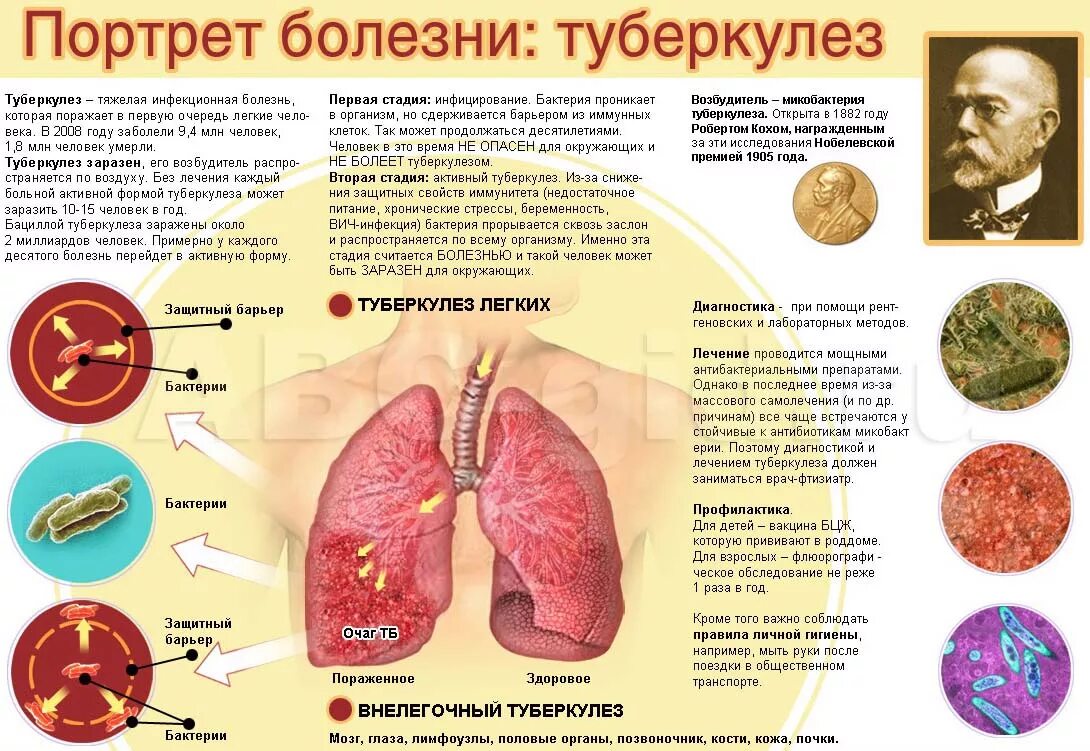 Инфекция в организме. Туберкулёз это заболевание.