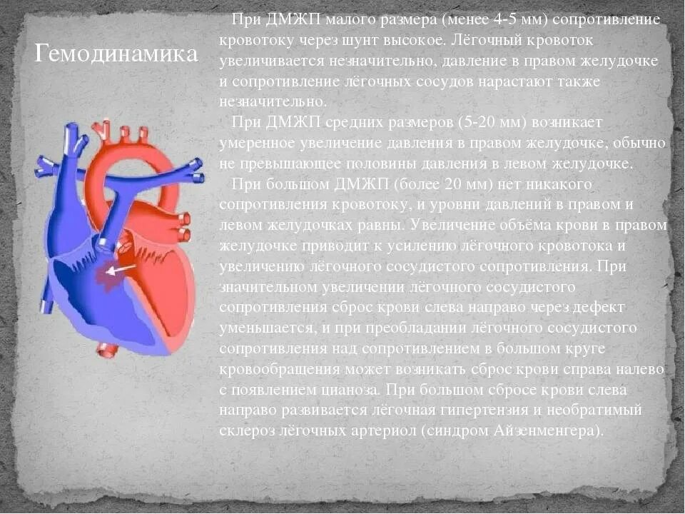 Мышечный дефект. Дефект межжелудочковой перегородки стадийность течения. дефект межжелудочковой перегородки гемодинамика. дмжп гемодинамика. гемодинамика дефекта межжелудочковой перегородки сердца.