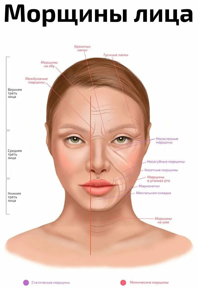 название морщин на лице. мимические морщины названия. название морщин на лице. название морщин на лице. мимические морщины улыбка.