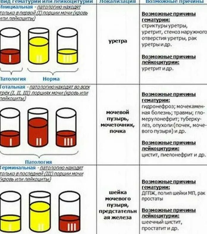Может ли моча менять
