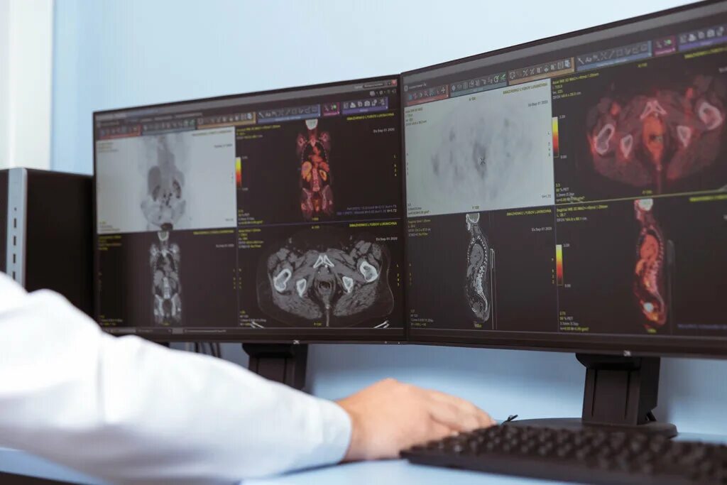 Пэт технолоджи балашиха. Центр ядерной медицины пермь. Пэт кт центр ядерной медицины в москве. Пэт технолоджи екатеринбург. Центр ядерной медицины пермь братьев игнатовых 2.