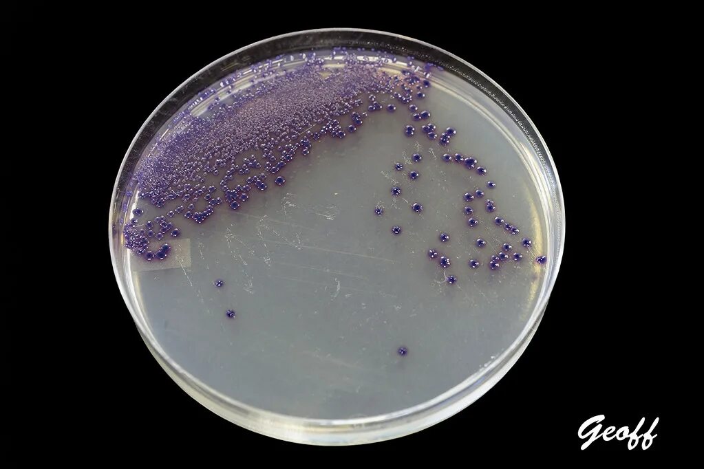 Staphylococcus e coli