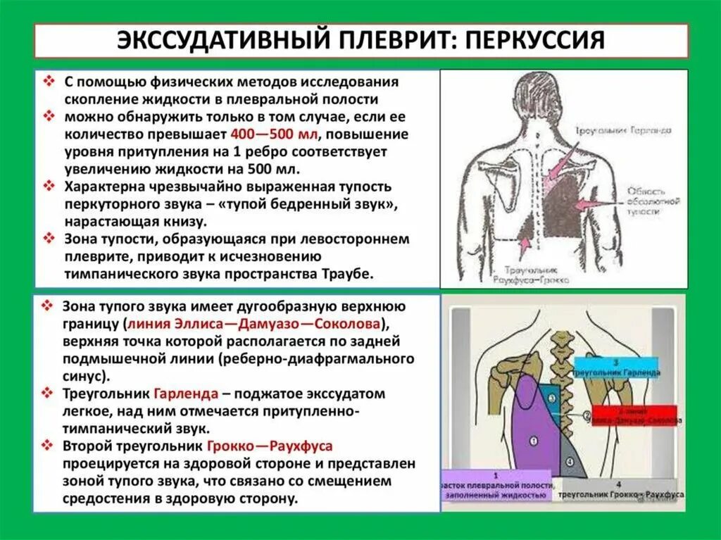 После операции болит легкое. Данные перкуссии при экссудативном плеврите. Перкуторные данные при экссудативном плеврите.. Гидроторакс перкуссии при аускультации. Аускультативно при экссудативном плеврите.