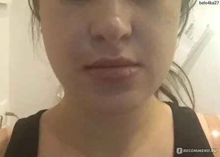 Почему держится отек