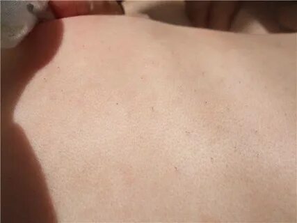 Волосы на спине что делать