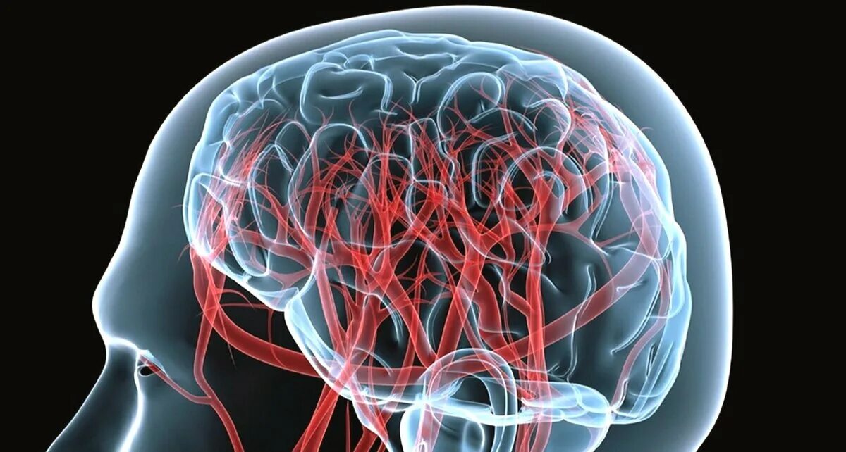 Заболевание сосудов мозга. Кровообращение мозга. Кровоток головного мозга. Сосудистая система.