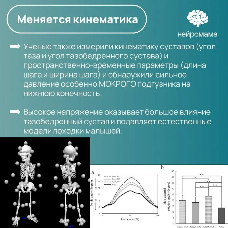Нейромама. Нейромама
