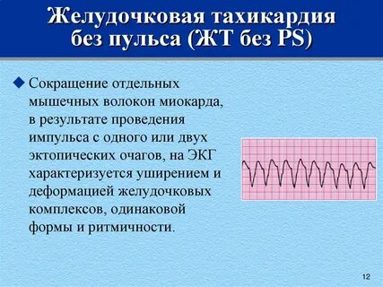 Сердцебиение побочный эффект