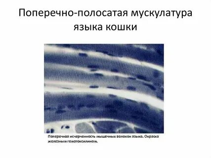 Исчерченность сердечной мышечной ткани