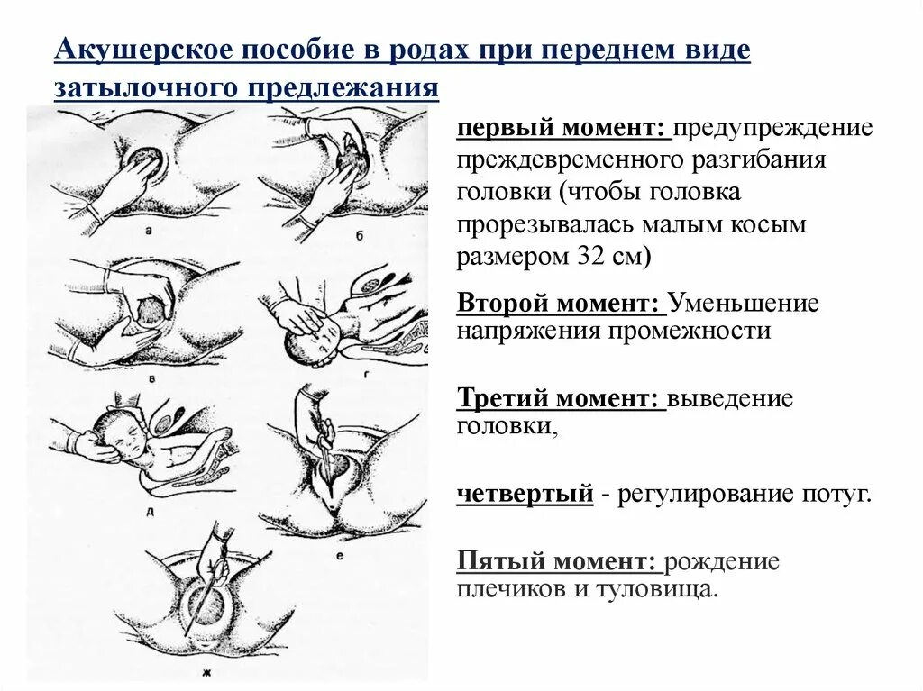 Каких двух родов были мужчины перечислите. Акушерское пособие передний вид затылочного предлежания плода. Акушерское пособие в родах при затылочном предлежании. Оказание ручного пособия при затылочном предлежании. Акушерское пособие в родах при переднем виде затылочного предлежания.