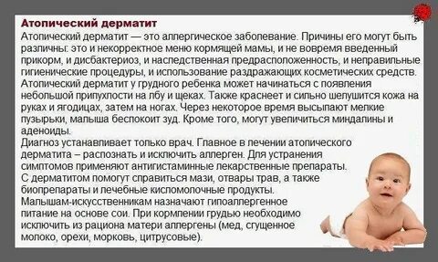 Атопический дерматит у грудничка причины