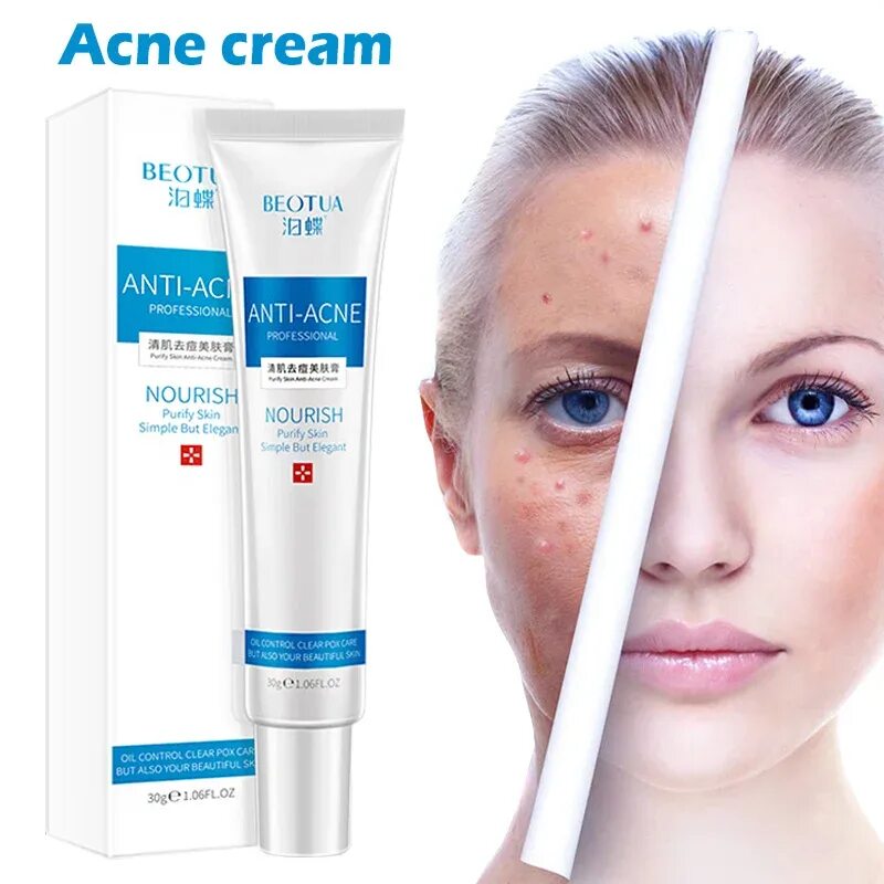 Крем " Anti-acne" от прыщей " BEOTUA ", 30гр.,. Крем acne scar removal от прыщей. Skin acne крем от прыщей. BEOTUA luofamiss крем от прыщей.