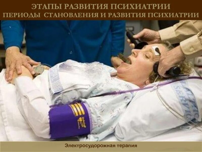 Аппарат электросудорожной терапии эстер. Электросудорожная терапия. Электро судоражная терапия. Электросудорожная терапия. Электросудорожная терапия полет над гнездом кукушки.