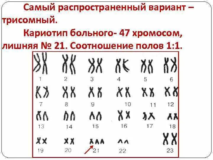 Количество хромосом в кариотипе человека. Кариотип. Гемофилия кариотип. Кариотип больного.